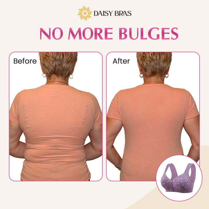 LAST DAY SALE 80% OFF - Comfortable & Convenient Front Button Bra